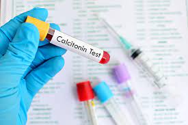 Calcitonin test