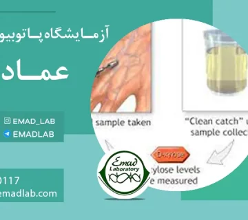 Xylose absorption test