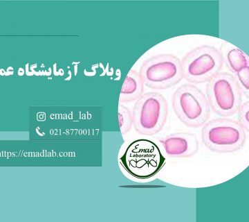 آنتی-بادی-بوردتلا-سیاه-سرفه-(خون)