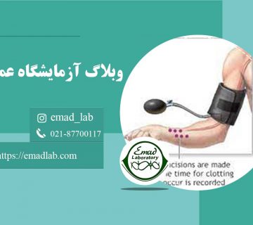 تست-زمان-خونریزی