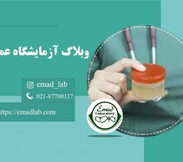 پروتئین-بنس-جونز-(ادرار)