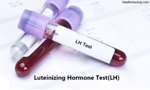 آزمایش هورمون لوتئینه کننده 
