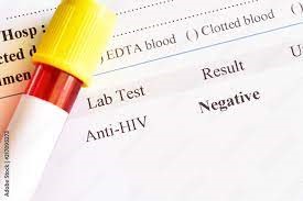 HIV منفی 