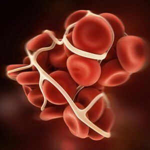 رنج نرمال آنتی فسفولیپید 