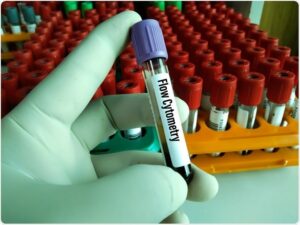 آزمایش فلوسایتومتری 