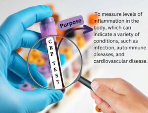 پروتئین واکنشی 