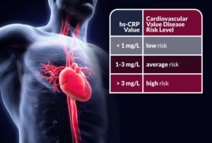 رنج نرمال پروتئین c