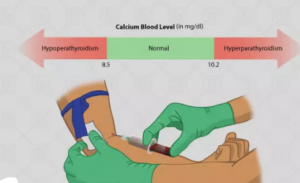 بالا بودن کلسیم