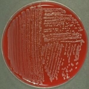  تست ویدال در لوله