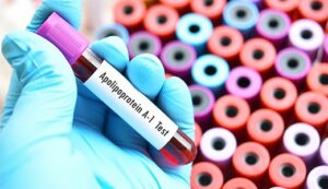 آپولیپوپروتئین 