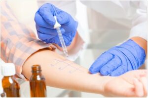 نحوه تست آلرژی 