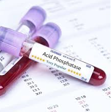 اسید فسفاتاز 