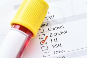 نشانه یائسگی