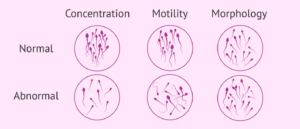 آزمایش اسپرم