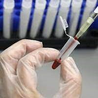 آزمایش زونا