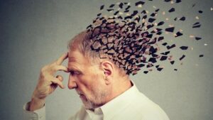 بیماری آلزایمر 