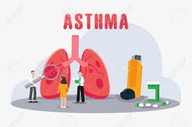 آسم ریوی 