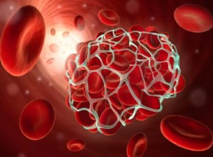 مقدار D- dimer نرمال