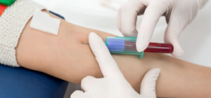 تست فروکتوزامین 