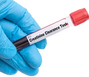 کلیرانس کراتینین 