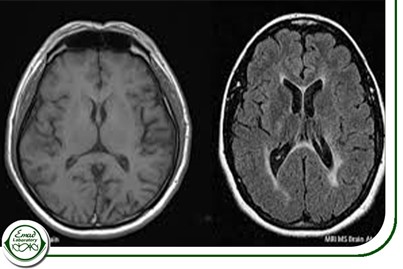 ام آر آی (MRI)