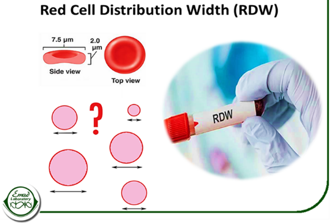  RDW در آزمایش خون به چه معناست؟