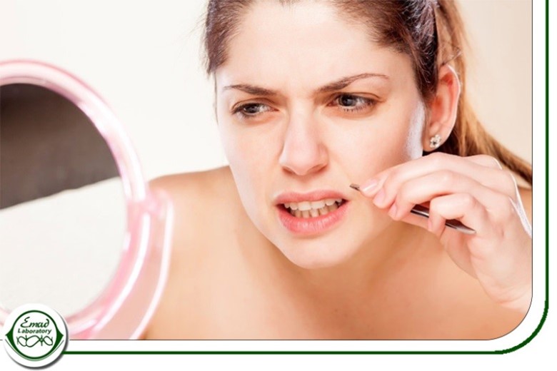 آزمایش تستوسترون در زنان