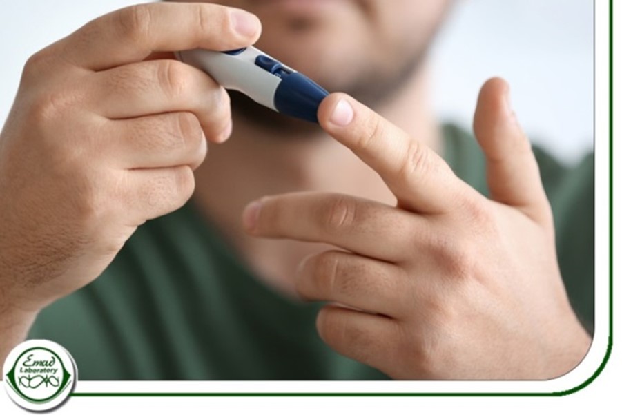 تفسیر آزمایش تستسترون  testosterone