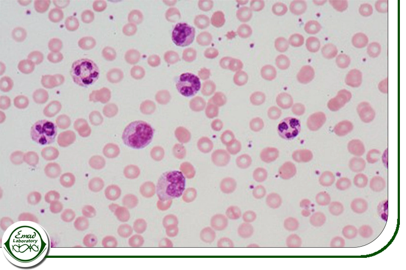 ارزیابی پاسخ به درمان