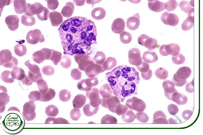 اهمیت شمارش نوتروفیل در تشخیص بیماری‌ها