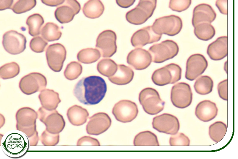 اهمیت لنفوسیت‌ها در پاسخ ایمنی اکتسابی و تغییرات آن در بیماری‌ها