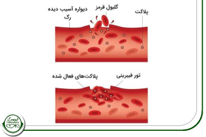 آزمایشات متداول مرتبط با تست بیلی روبین