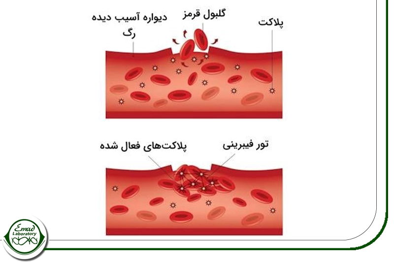 آزمایشات متداول مرتبط با تست بیلی روبین
