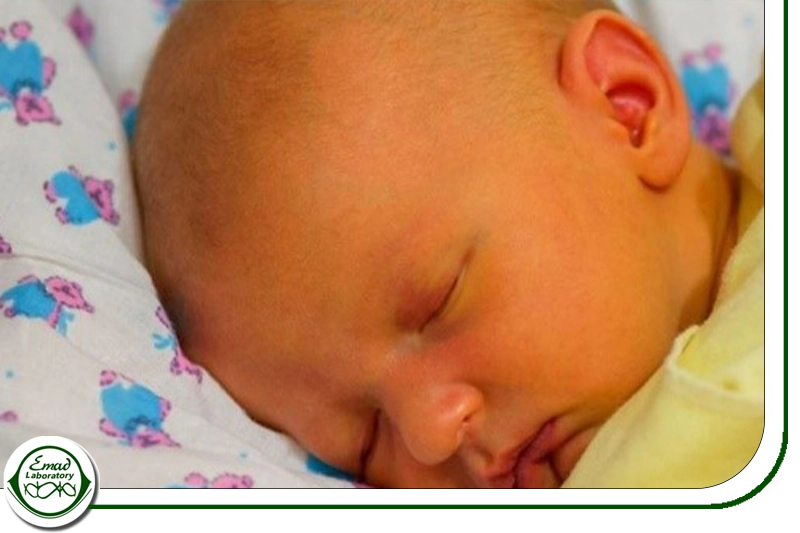 اهمیت تست بیلی روبین