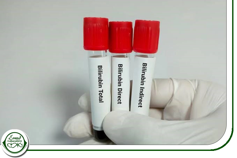 بیلی روبین غیر مستقیم