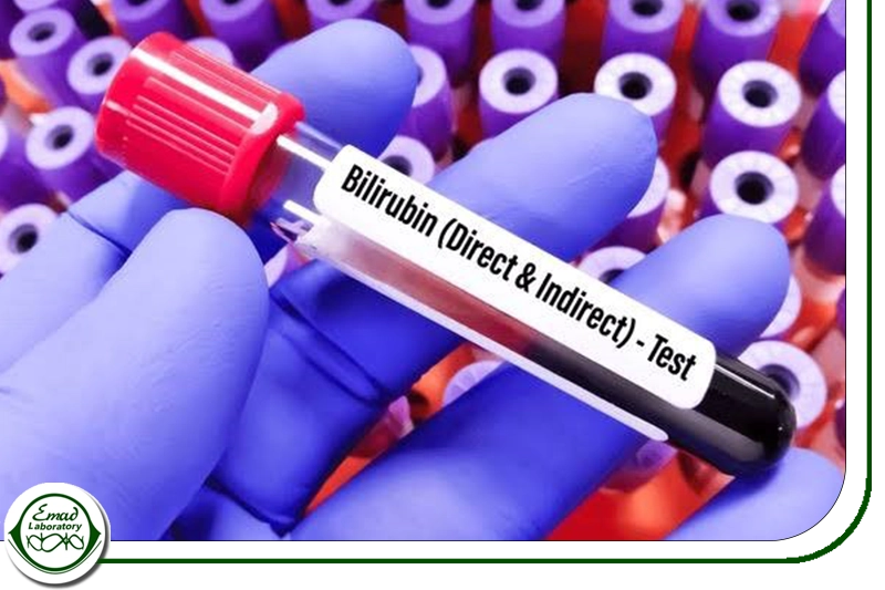 بیلی روبین غیر مستقیم 02