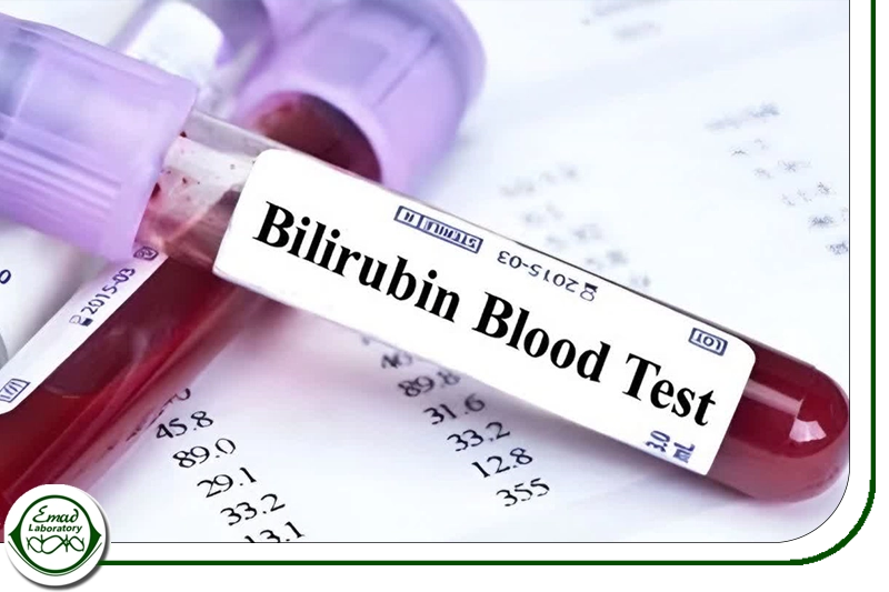 تست بیلی روبین 01