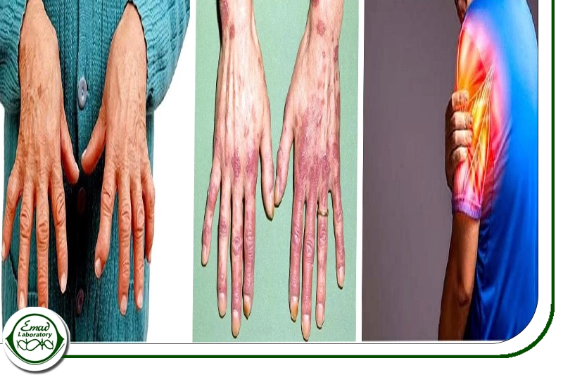 سطح پایین تر ازحد بیل روبین