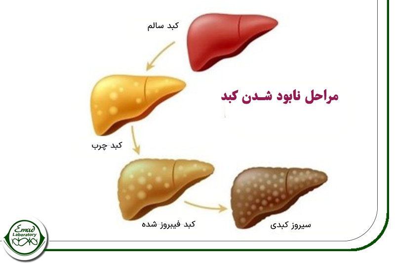 علت بالا بودن بیلی روبین