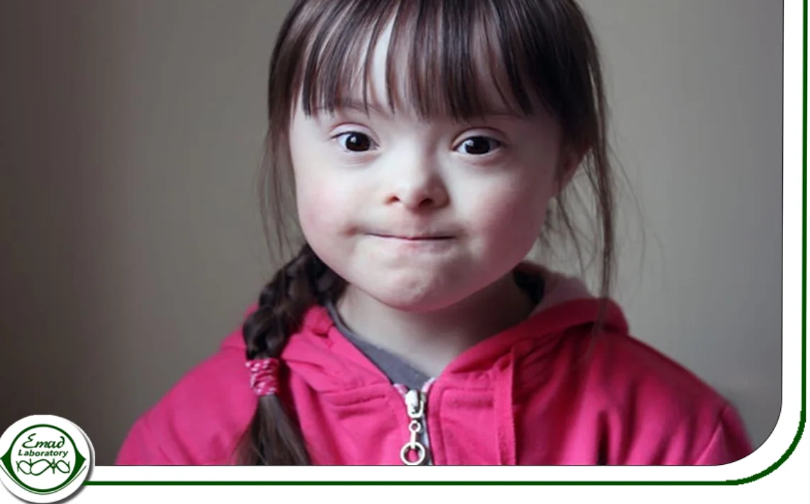 وراثت اتوزوم غالب