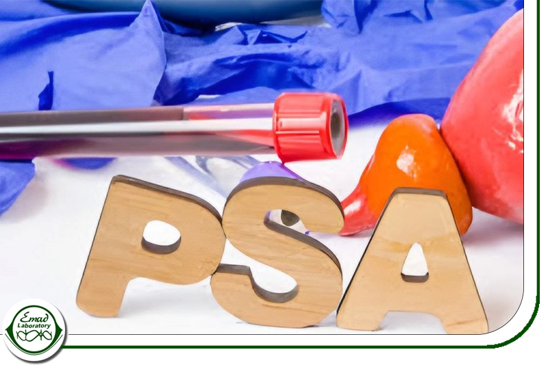 آزمایش خون PSAپروستات
