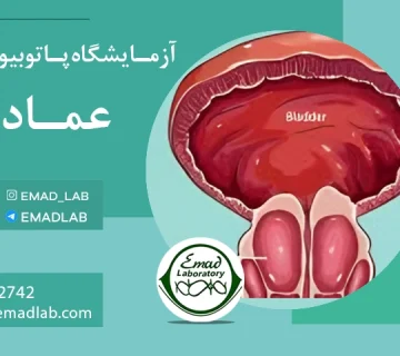 آزمایش خون پروستات2
