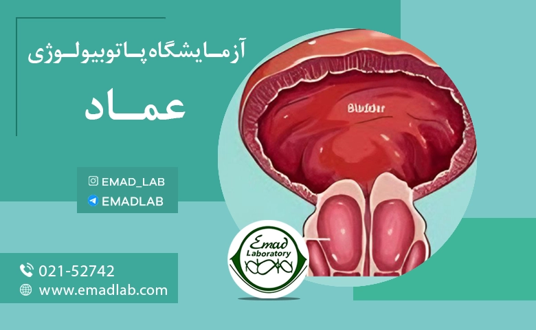 آزمایش خون پروستات2