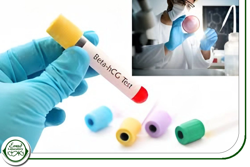 آزمایش کمی ( Quantitative یا Beta HCG )