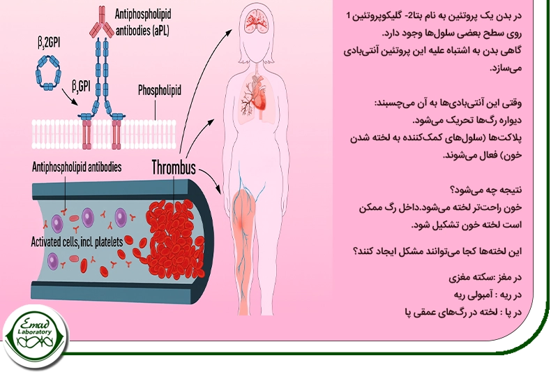 آنتی بادی بتا 2 1گلیکوپروتئین