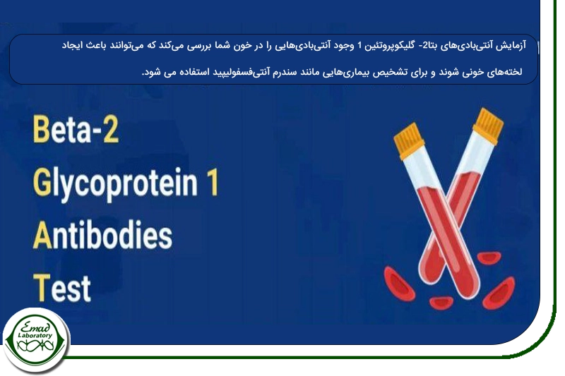 آنتی بادی بتا 2- گلیکو پروتئین