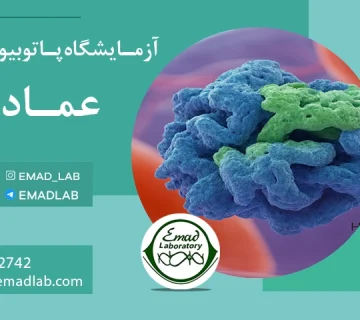 اسپوندیلیت آنکلیوزن