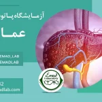 بیماری خودایمنی کبد (Autoimmune Hepatitis)