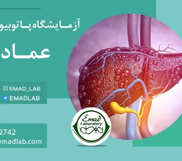بیماری خودایمنی کبد (Autoimmune Hepatitis)