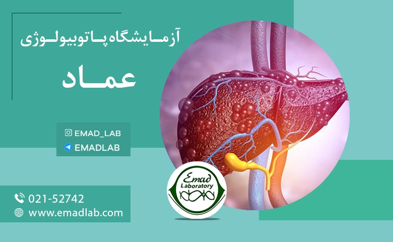 بیماری خودایمنی کبد (Autoimmune Hepatitis)